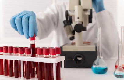 Blood Anaesthesiology Doctors in Janakpuri