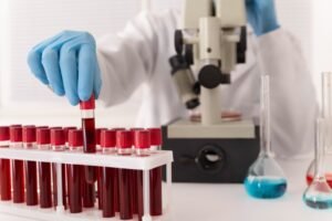 Laboratory technician handling blood samples for transfusion at the best blood transfusions services in Ghaziabad.